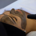 Carbon Peel Facial