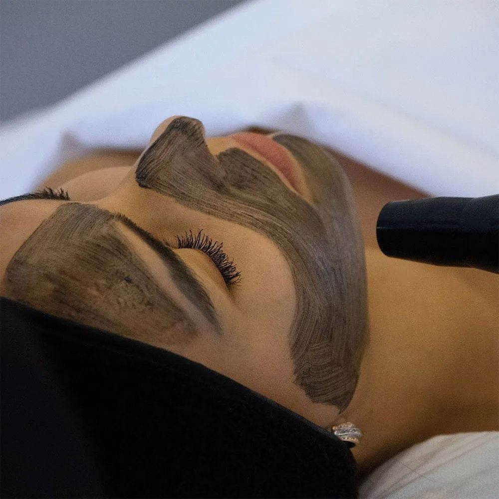 Carbon Peel Facial