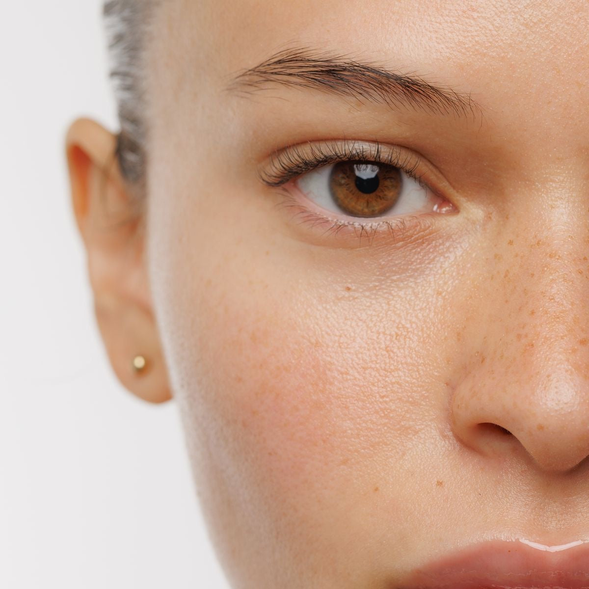 Polynucleotides Under Eye Treatment